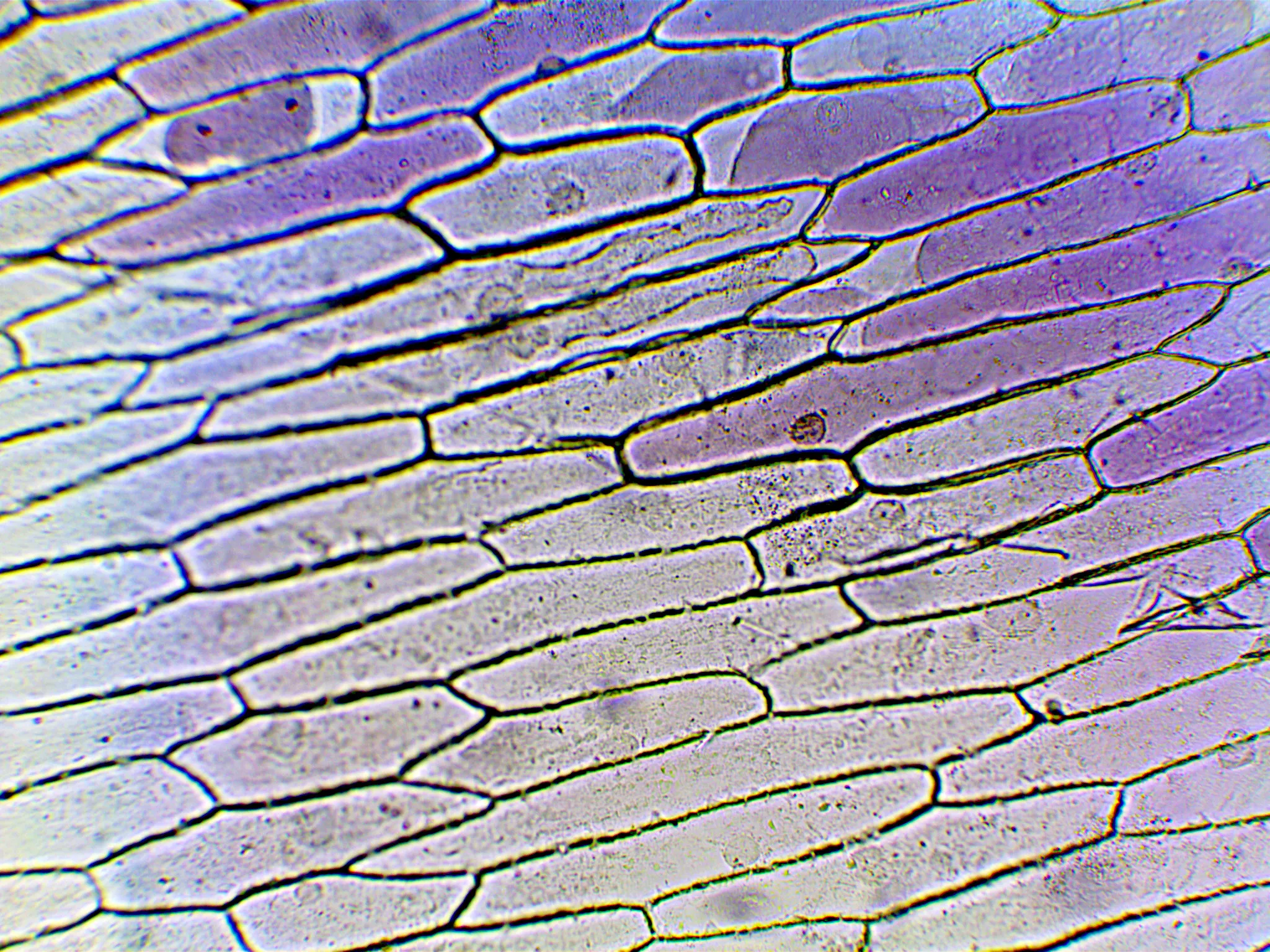 Onion cells magnified 100 times